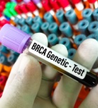 סרטן השחלות - תמונת המחשה